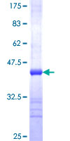 ab162026 on a 12.5% SDS-PAGE stained with Coomassie Blue.
