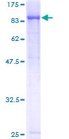 ab161065 on a 12.5% SDS-PAGE stained with Coomassie Blue.
