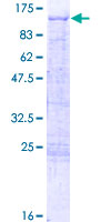 ab159641 on a 12.5% SDS-PAGE stained with Coomassie Blue.
