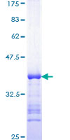 ab159642 on a 12.5% SDS-PAGE stained with Coomassie Blue.