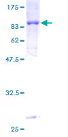 ab162381 on a 12.5% SDS-PAGE stained with Coomassie Blue.