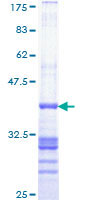 ab162382 on a 12.5% SDS-PAGE stained with Coomassie Blue.