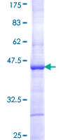 ab159643 on a 12.5% SDS-PAGE stained with Coomassie Blue.