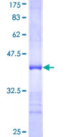 ab161642 on a 12.5% SDS-PAGE stained with Coomassie Blue.