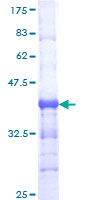 ab164388 on a 12.5% SDS-PAGE stained with Coomassie Blue.