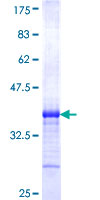 ab161125 on a 12.5% SDS-PAGE stained with Coomassie Blue.