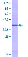 ab160941 on a 12.5% SDS-PAGE stained with Coomassie Blue.