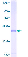 ab160578 on a 12.5% SDS-PAGE stained with Coomassie Blue.
