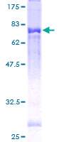 ab159655 on a 12.5% SDS-PAGE stained with Coomassie Blue.
