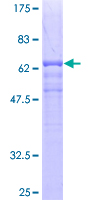 ab159656 on a 12.5% SDS-PAGE stained with Coomassie Blue.