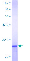 ab161115 on a 12.5% SDS-PAGE stained with Coomassie Blue.