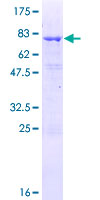 ab159657 on a 12.5% SDS-PAGE stained with Coomassie Blue.