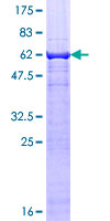ab159663 on a 12.5% SDS-PAGE stained with Coomassie Blue.