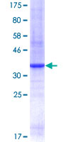ab159664 on a 12.5% SDS-PAGE stained with Coomassie Blue.