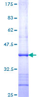 ab159665 on a 12.5% SDS-PAGE stained with Coomassie Blue.