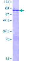 ab164418 on a 12.5% SDS-PAGE stained with Coomassie Blue.