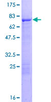 ab162131 on a 12.5% SDS-PAGE stained with Coomassie Blue.
