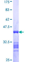 ab162132 on a 12.5% SDS-PAGE stained with Coomassie Blue.
