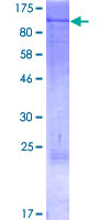 ab153440 on a 12.5% SDS-PAGE stained with Coomassie Blue.