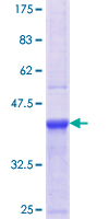 ab153441 on a 12.5% SDS-PAGE stained with Coomassie Blue.
