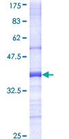 ab159671 on a 12.5% SDS-PAGE stained with Coomassie Blue.