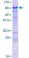 ab160979 on a 12.5% SDS-PAGE stained with Coomassie Blue.