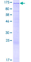 ab153625 on a 12.5% SDS-PAGE stained with Coomassie Blue.