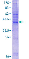 ab161180 on a 12.5% SDS-PAGE stained with Coomassie Blue.