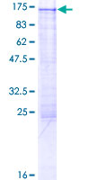 ab162875 on a 12.5% SDS-PAGE stained with Coomassie Blue.