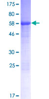 ab163351 on a 12.5% SDS-PAGE stained with Coomassie Blue.