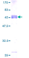 ab162527 on a 12.5% SDS-PAGE stained with Coomassie Blue.