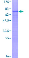 ab164436 on a 12.5% SDS-PAGE stained with Coomassie Blue.