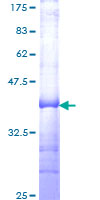 ab162482 on a 12.5% SDS-PAGE stained with Coomassie Blue.