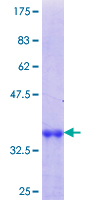 ab161427 on a 12.5% SDS-PAGE stained with Coomassie Blue.