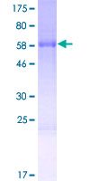 ab162243 on a 12.5% SDS-PAGE stained with Coomassie Blue.