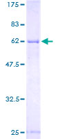 ab161664 on a 12.5% SDS-PAGE stained with Coomassie Blue.