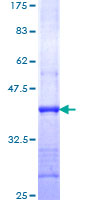 ab159688 on a 12.5% SDS-PAGE stained with Coomassie Blue.