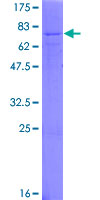 ab159690 on a 12.5% SDS-PAGE stained with Coomassie Blue.