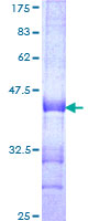 ab163718 on a 12.5% SDS-PAGE stained with Coomassie Blue.