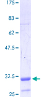 ab163719 on a 12.5% SDS-PAGE stained with Coomassie Blue.