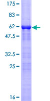 ab164816 on a 12.5% SDS-PAGE stained with Coomassie Blue.