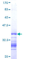 ab164817 on a 12.5% SDS-PAGE stained with Coomassie Blue.