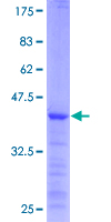 ab159693 on a 12.5% SDS-PAGE stained with Coomassie Blue.
