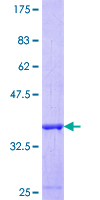 ab159694 on a 12.5% SDS-PAGE stained with Coomassie Blue.