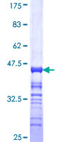 ab161074 on a 12.5% SDS-PAGE stained with Coomassie Blue.