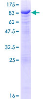 ab162576 on a 12.5% SDS-PAGE stained with Coomassie Blue.