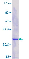 ab162577 on a 12.5% SDS-PAGE stained with Coomassie Blue.