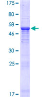 ab165802 on a 12.5% SDS-PAGE stained with Coomassie Blue.