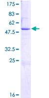 ab165653 on a 12.5% SDS-PAGE stained with Coomassie Blue.