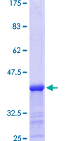 ab159696 on a 12.5% SDS-PAGE stained with Coomassie Blue.